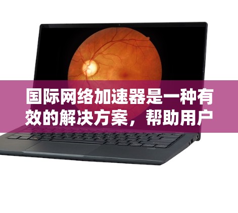 国际网络加速器是一种有效的解决方案,帮助用户快速访问国外网站,缓解延迟问题。以下是对国际网络加速器的详细分析和使用建议